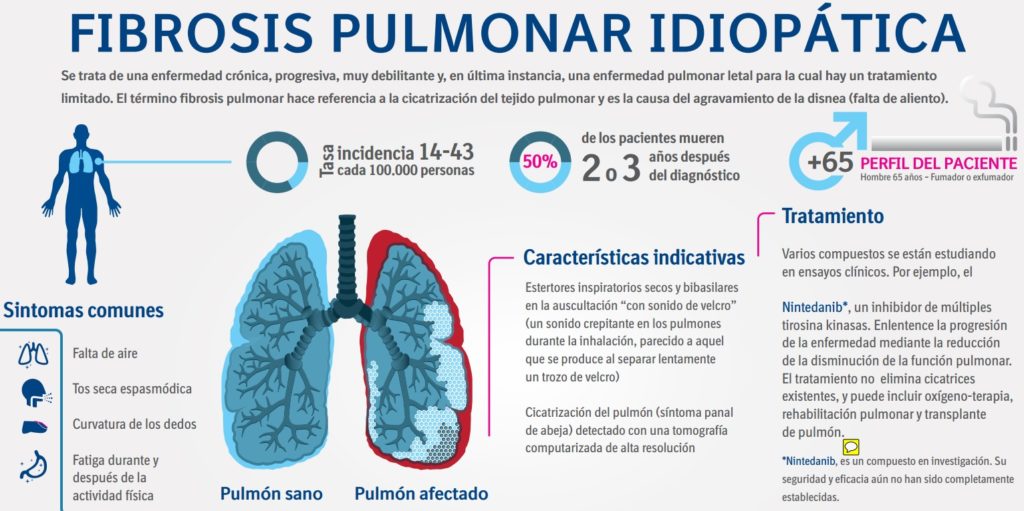fibrosis-pulmonar