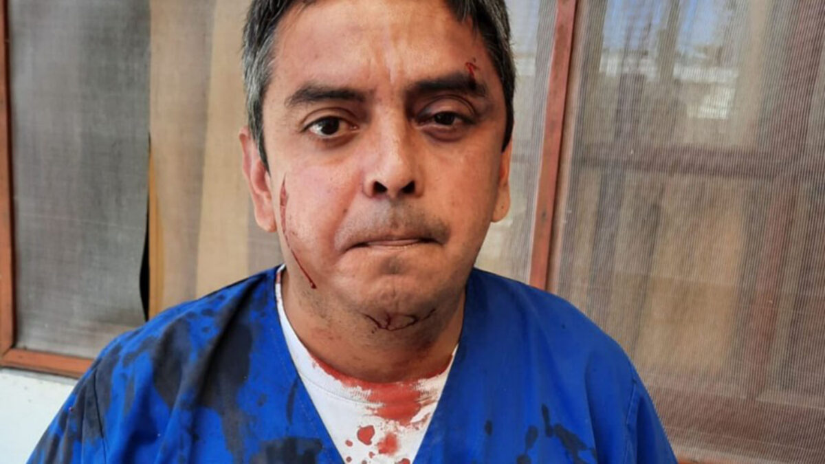atacó secretario de salud