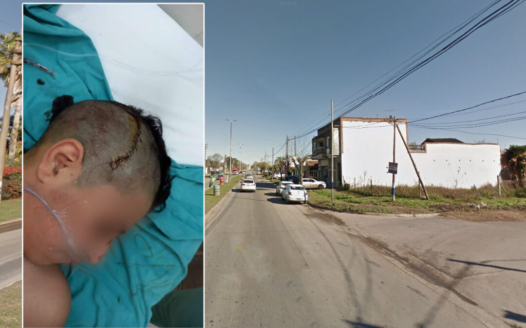 Un menor de 14 años fue atropellado en La Plata y sufrió fractura de cráneo: buscan testigos del accidente