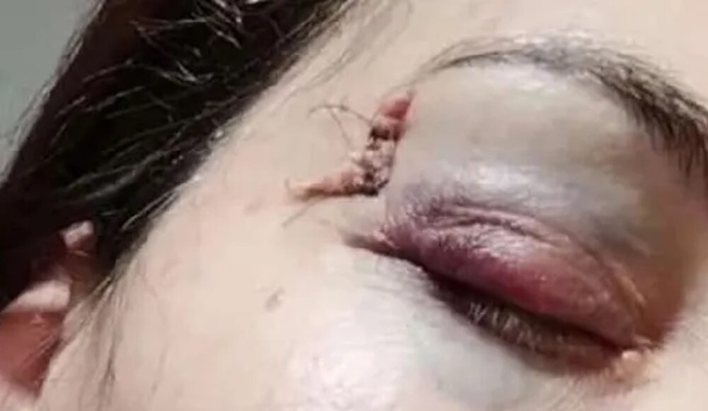 golpeó maestra villegas