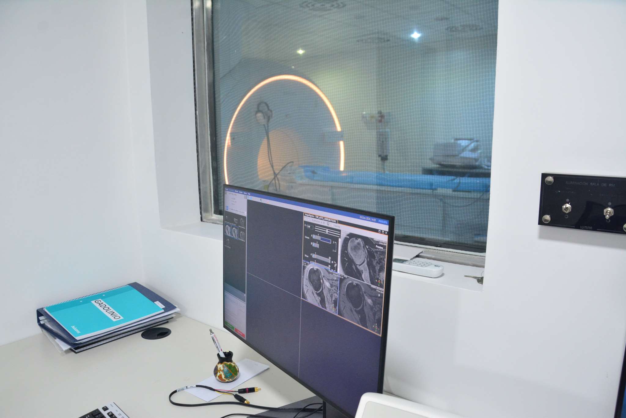 resonador hospital rossi